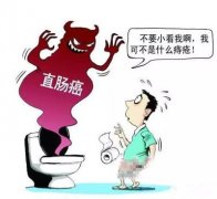 <b>痔疮会癌变吗？</b>